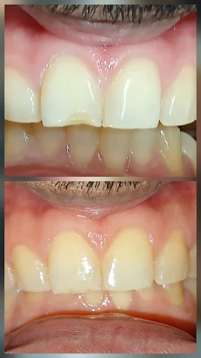 Pooja Smile Care Dental Gallery Image 31